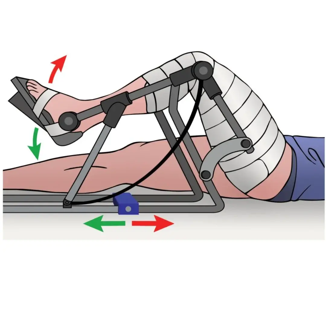 Teal Blue Back Pain Physiotherapy Marketing Instagram Post (1) Teal Blue Back Pain Physiotherapy Marketing Instagram Post (1)