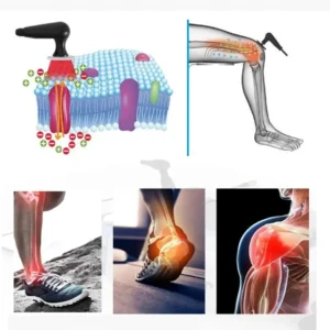 SMART TECAR Therapy Unit – Advanced Physiotherapy Machine - Image 4